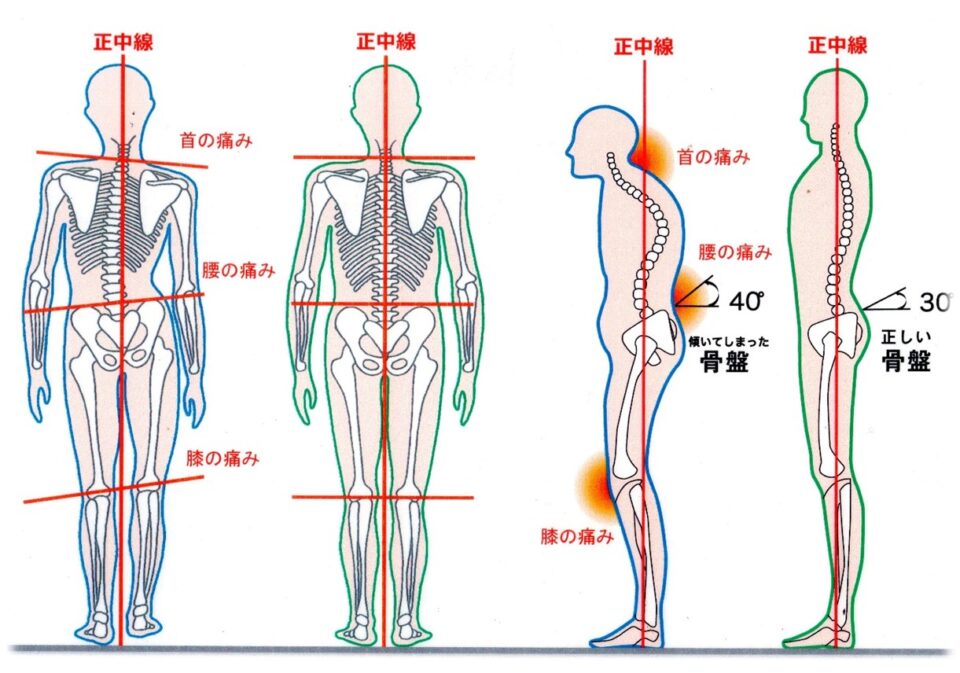 正しい姿勢と崩れた姿勢